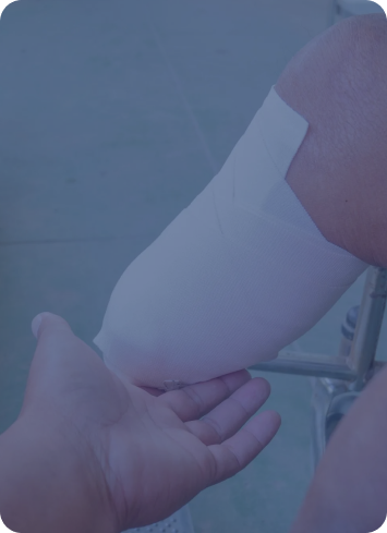 Amputation Injury
